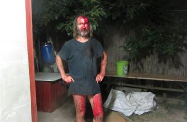 Brutalni napad Romov, s palicami nad vaščana zaradi maščevanja?